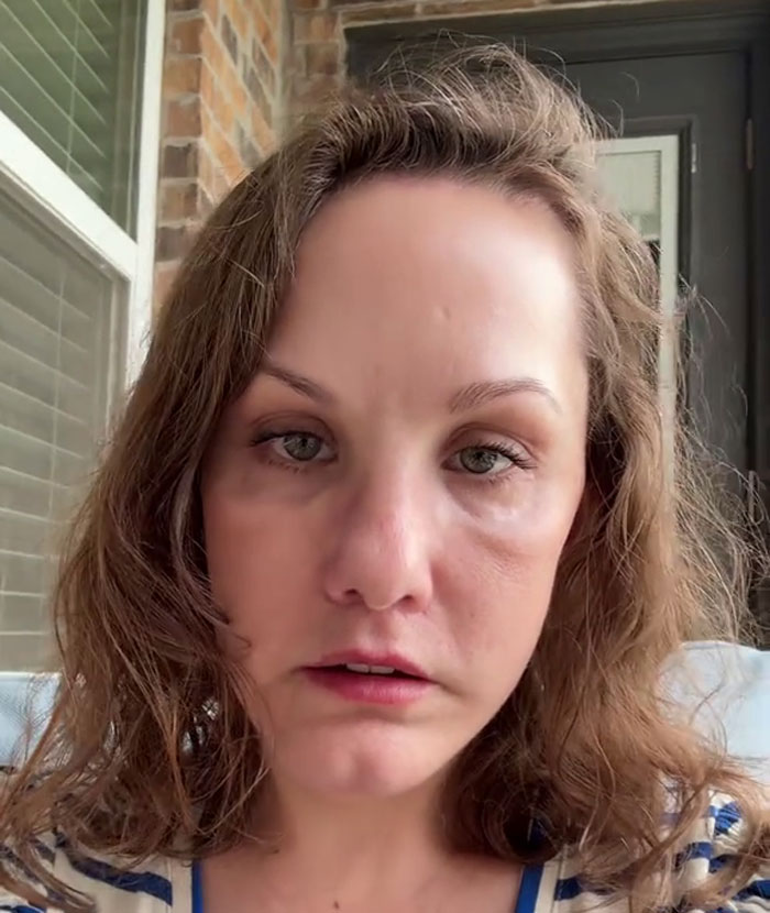 Middle-aged woman showing face close-up after radical glow up, highlighting best face lift results. Middle-aged woman showing face close-up after radical glow up, highlighting best face lift results.