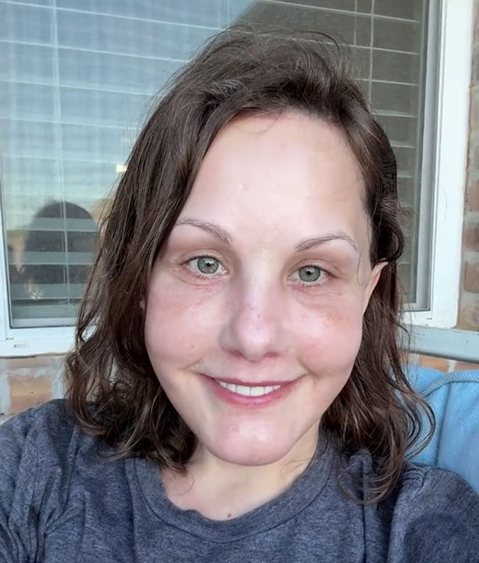 Woman with natural look and glowing skin smiling, showcasing a remarkable face lift and radical glow up at age 51. Woman with natural look and glowing skin smiling, showcasing a remarkable face lift and radical glow up at age 51.