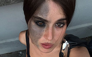 Fascinating Birthmarks Shared By People Online That You Have To See To Believe