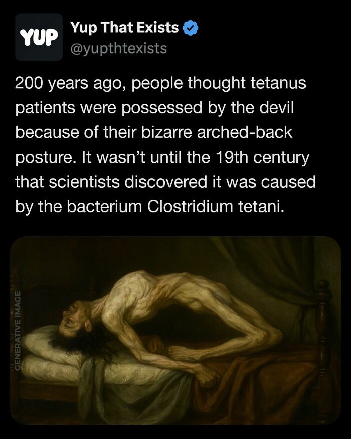 Tweet from Yup That Exists explaining tetanus was once believed to be possession, with an image of a person in a severe arched-back posture.
