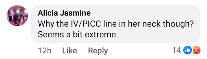 Comment discussing Bella Hadid’s hospital photos, questioning the use of an IV/PICC line in her neck as extreme. Comment discussing Bella Hadid’s hospital photos, questioning the use of an IV/PICC line in her neck as extreme.
