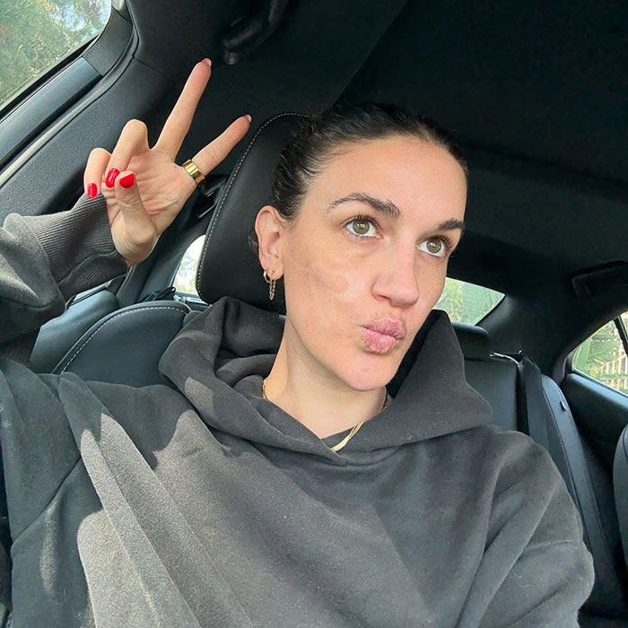Woman in a car making a peace sign, discussing $90,000 repairs after celebrity facialist allegedly caused permanent disfigurement Woman in a car making a peace sign, discussing $90,000 repairs after celebrity facialist allegedly caused permanent disfigurement