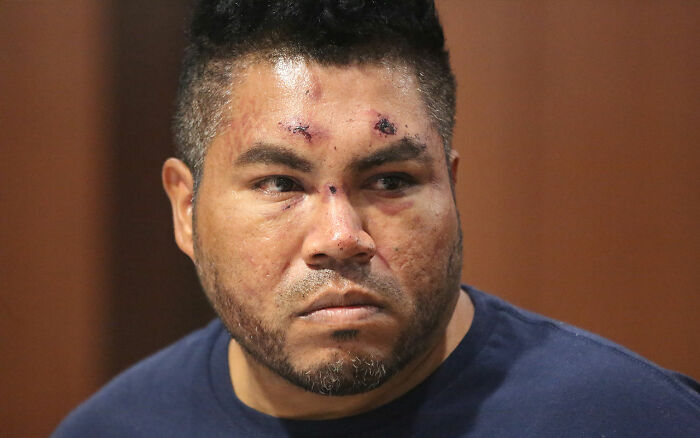 Maniac driver with facial injuries giving a shocking response to cops after running over teen who rejected advances