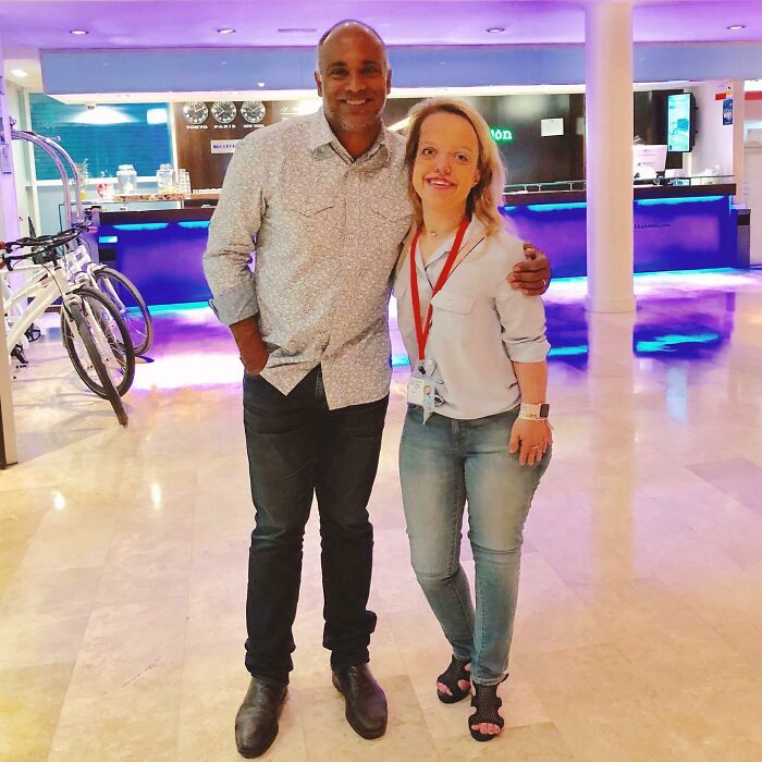 31-year-old woman with dwarfism and height surgery as a teen posing with a man in a brightly lit indoor space. 31-year-old woman with dwarfism and height surgery as a teen posing with a man in a brightly lit indoor space.