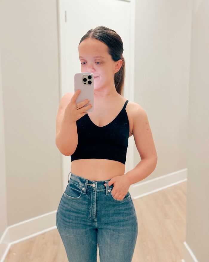 31YO woman with dwarfism taking a mirror selfie wearing black crop top and high-waisted jeans showing transformation after height surgery. 31YO woman with dwarfism taking a mirror selfie wearing black crop top and high-waisted jeans showing transformation after height surgery.