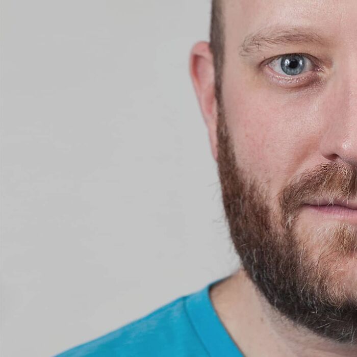 Portrait of a man showing unique curly hair and beard, illustrating strong family DNA in side-by-side genetic portraits.