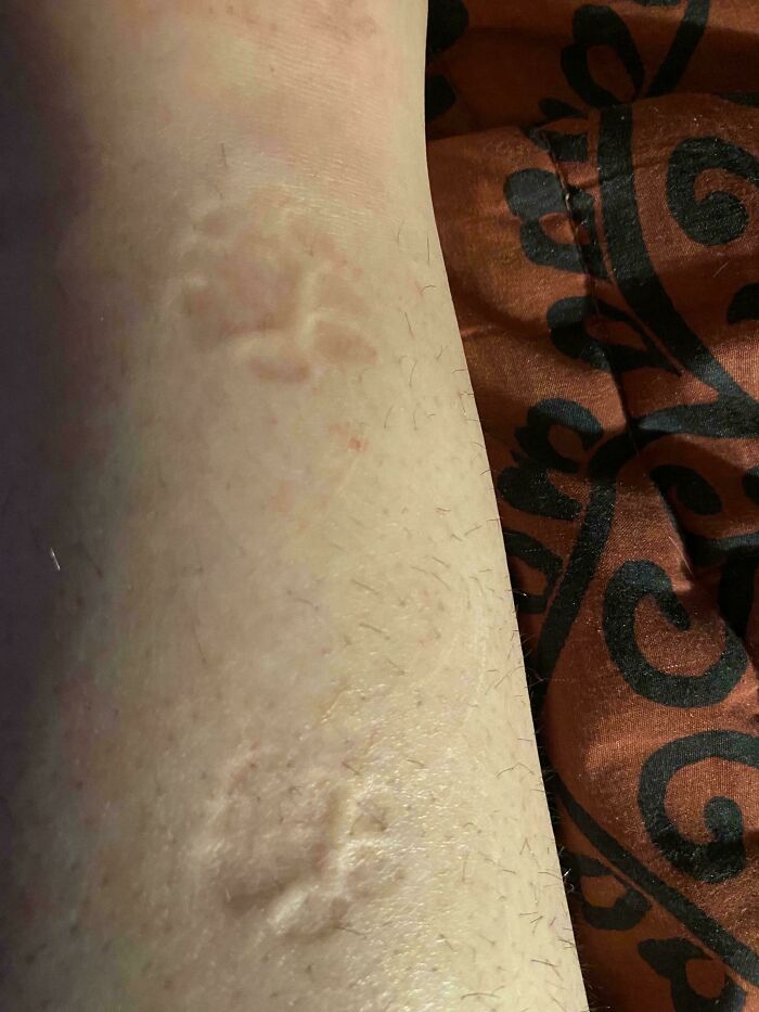 Faint cat paw prints imprinted on human skin showing cute cat paw prints in a close-up view on a light background.