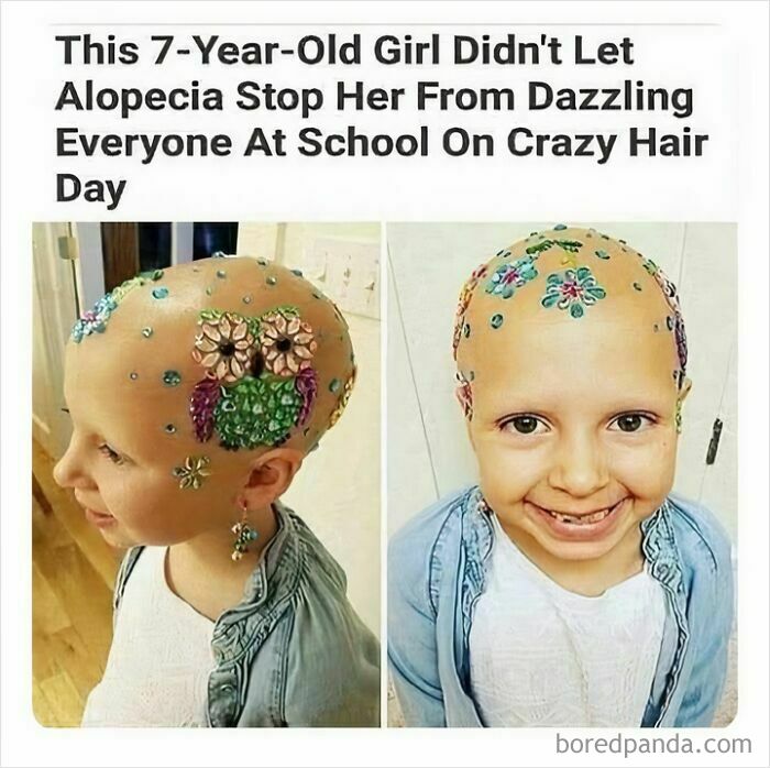 Seven-year-old girl with alopecia decorated her bald head with colorful gems, showcasing heartwarming positivity on crazy hair day.