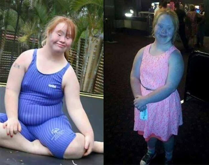 Young woman with Down syndrome enjoying outdoor activity and smiling warmly, inspiring heartwarming stories to cleanse negativity.