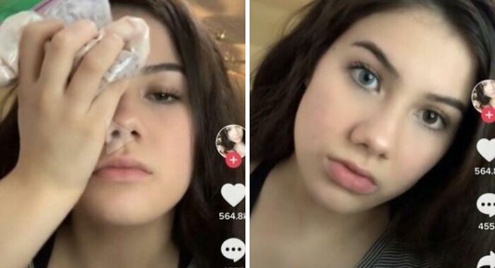 Young woman in two TikTok screenshots, one holding ice to her face, showcasing popular TikTok moments that spark curiosity.
