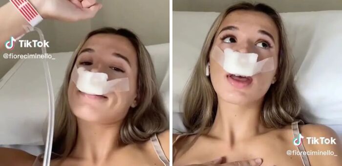 Young woman with a bandaged nose in hospital bed, featured in TikTok screenshots that might make you feel very smart.