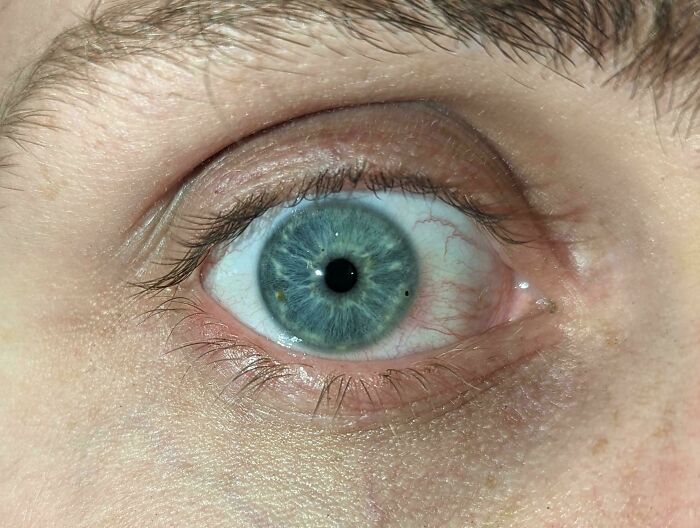 Close-up of a human eye showing clear iris details, illustrating unsettling moments from jobs that should pay more.