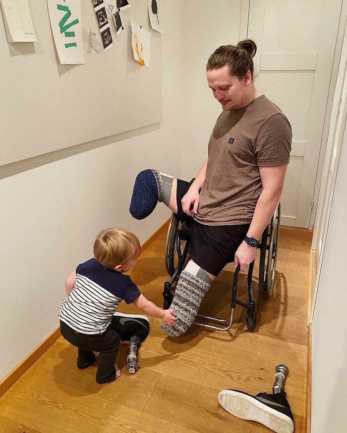 Child touching father's prosthetic leg as dad in wheelchair smiles, showing love and wholesome moments of amazing moms.