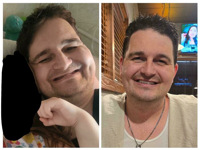 Side-by-side photos showing a man’s glow-up transformation, smiling and looking happier in the after picture.