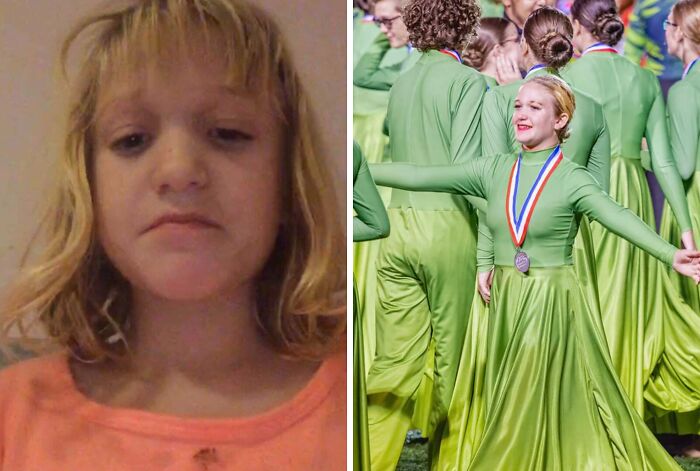 Side-by-side before and after glow-up showing a girl’s transformation with a medal in a green performance dress.