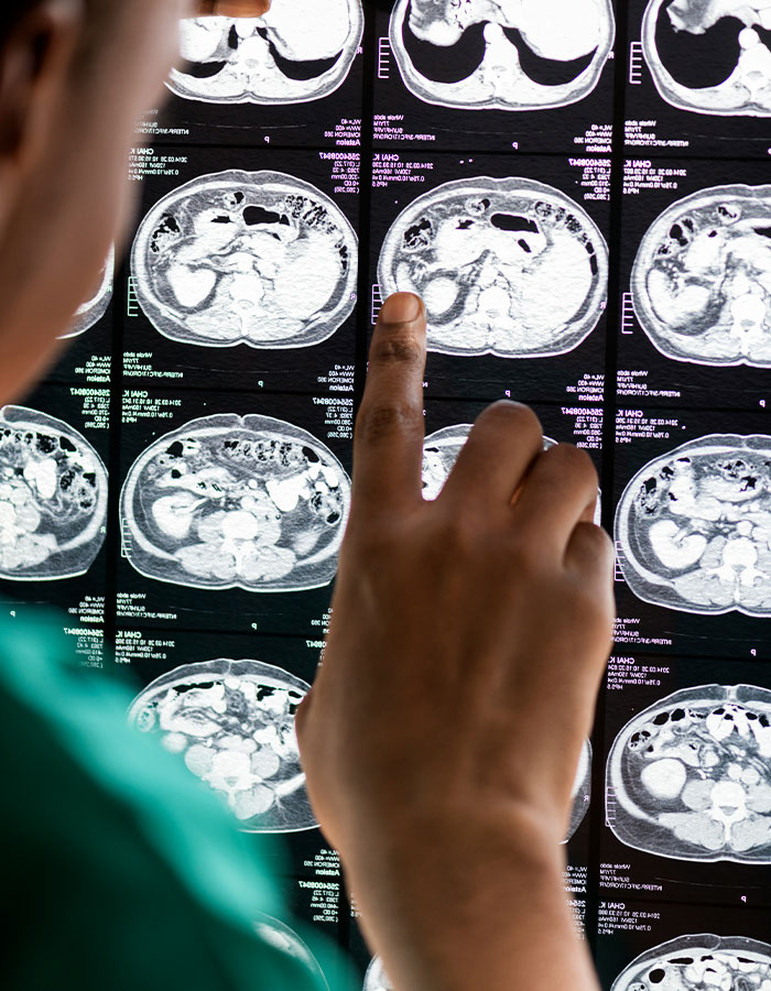 Mom’s Google Search Saved Her 6YO Boy When Doctors Couldn’t Explain His Collapse, Expert Weighs In Mom’s Google Search Saved Her 6YO Boy When Doctors Couldn’t Explain His Collapse, Expert Weighs In