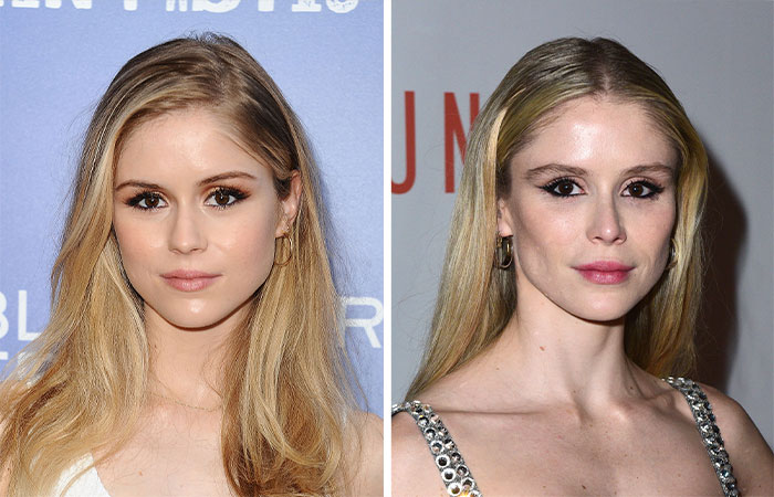 29 Celebrities Accused Of Ruining Their Beauty With Buccal Fat Removal