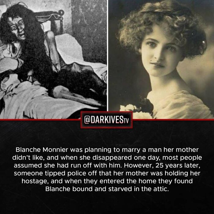 Black and white photo of Blanche Monnier healthy and starved in attic, illustrating terrifying facts and dark stories of our world.