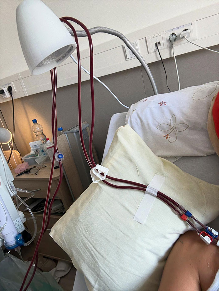 Hospital scene showing medical tubes attached to a patient lying on a bed with pillows and medical equipment nearby Hospital scene showing medical tubes attached to a patient lying on a bed with pillows and medical equipment nearby