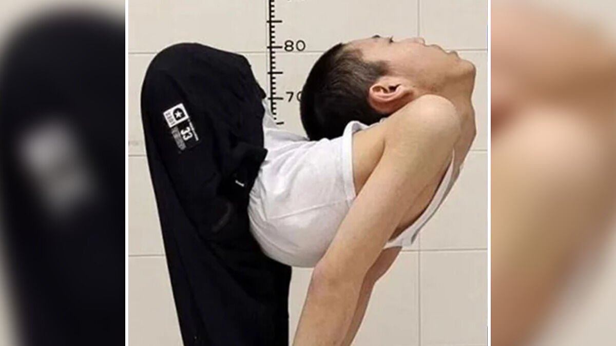 Boy bent at 180 degrees demonstrating a severe folded posture against a height measurement background indoors.