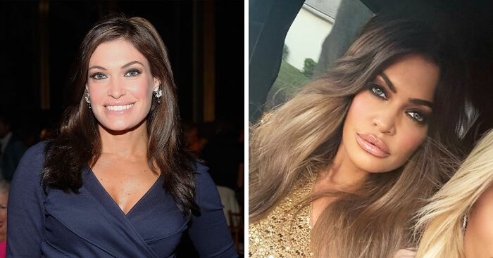 Fans Beg Kimberly Guilfoyle To “Stop With The Lips” After Drastic New Look