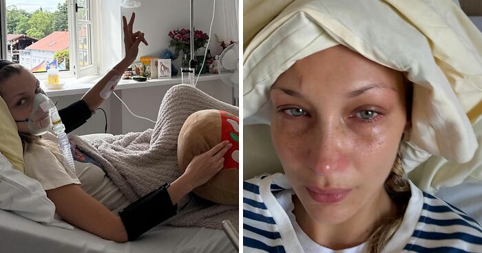 After Revealing “Years Of Invisible Suffering,” Bella Hadid Posts Alarming Photos From Hospital
