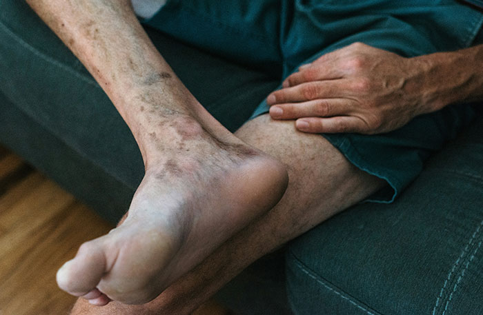 “3rd Date She Soiled Her Pants”: 47 Times People Couldn’t Believe How Gross Their Partners Were Being