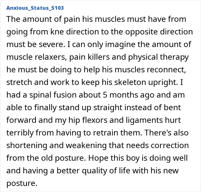 Comment about muscle pain and physical therapy after spinal fusion, relating to standing up straight from bent posture. Comment about muscle pain and physical therapy after spinal fusion, relating to standing up straight from bent posture.