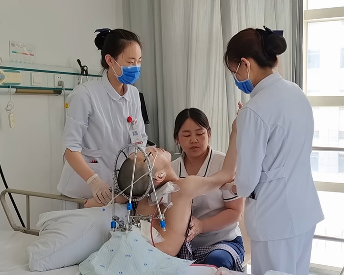 Patient known as folded boy receiving medical care from nurses and caretaker, showing progress toward standing up straight. Patient known as folded boy receiving medical care from nurses and caretaker, showing progress toward standing up straight.