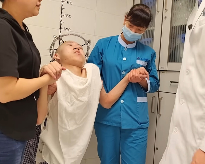 Young folded boy supported by medical staff as he attempts to stand up straight after long-term bending condition. Young folded boy supported by medical staff as he attempts to stand up straight after long-term bending condition.