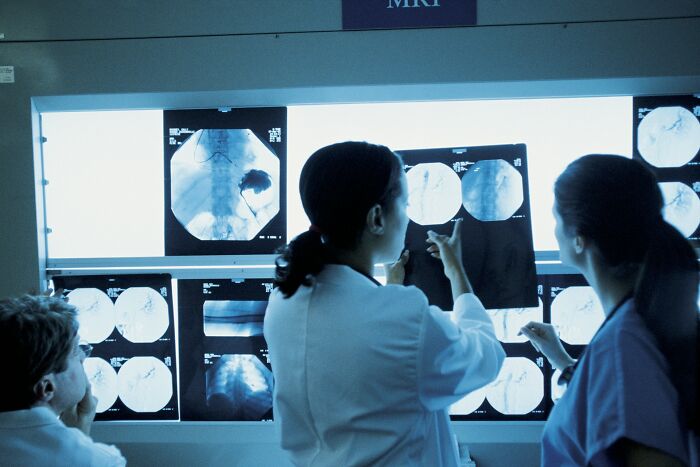 Three medical professionals examining MRI scans, highlighting patients who defied medical odds.