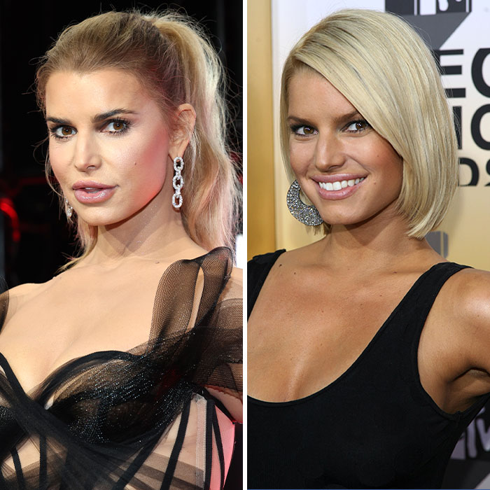 Jessica Simpson wearing glamorous earrings and black outfits in two side-by-side photos fueling plastic surgery rumors. Jessica Simpson wearing glamorous earrings and black outfits in two side-by-side photos fueling plastic surgery rumors.