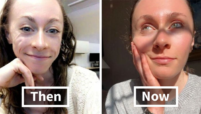 50 People Reveal Transformations That Changed Their Lives Completely