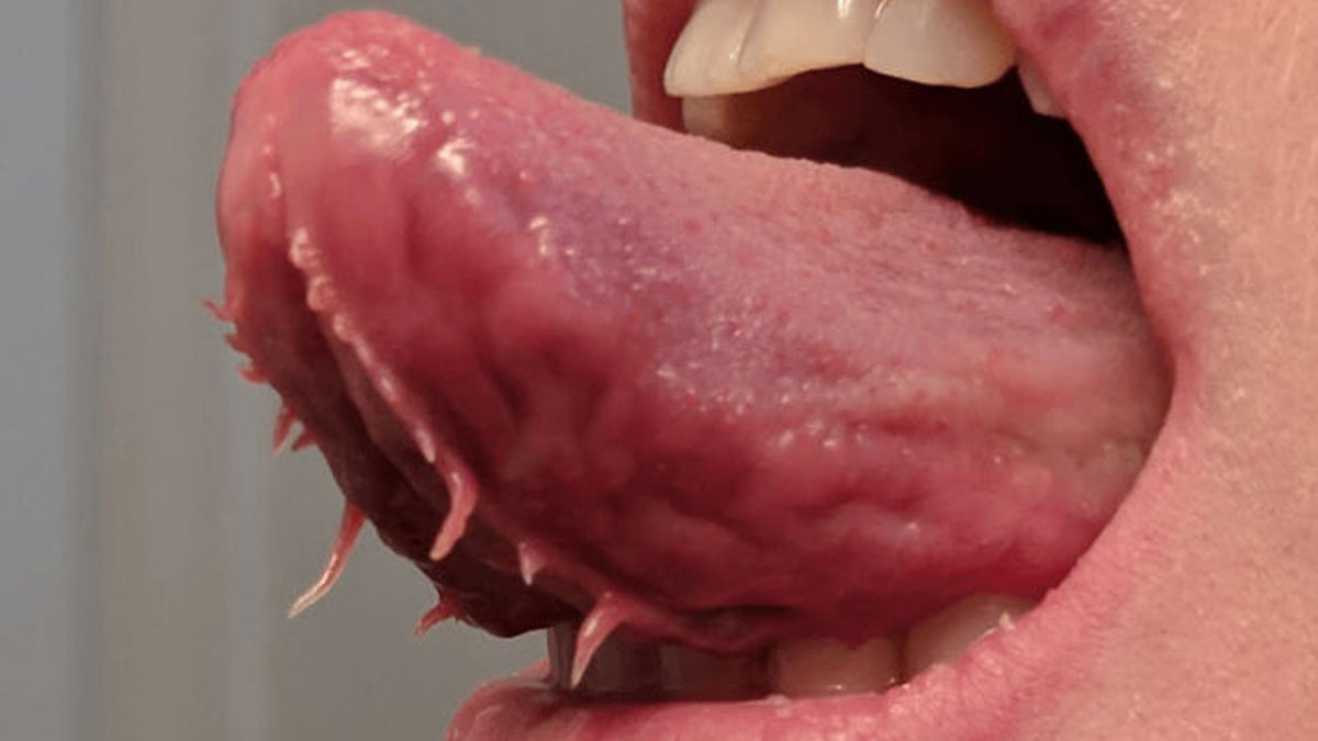 Close-up of a personu2019s tongue showing rare and surprising unique body features and textures.