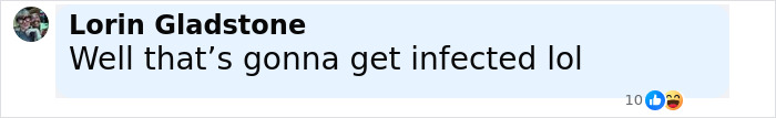 Comment by Lorin Gladstone saying well that’s gonna get infected lol, reacting to North West dermal piercing news. Comment by Lorin Gladstone saying well that’s gonna get infected lol, reacting to North West dermal piercing news.