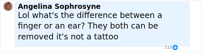 Comment about dermal piercing on finger by Angelina Sophrosyne, addressing concerns about removal and tattoo comparison. Comment about dermal piercing on finger by Angelina Sophrosyne, addressing concerns about removal and tattoo comparison.