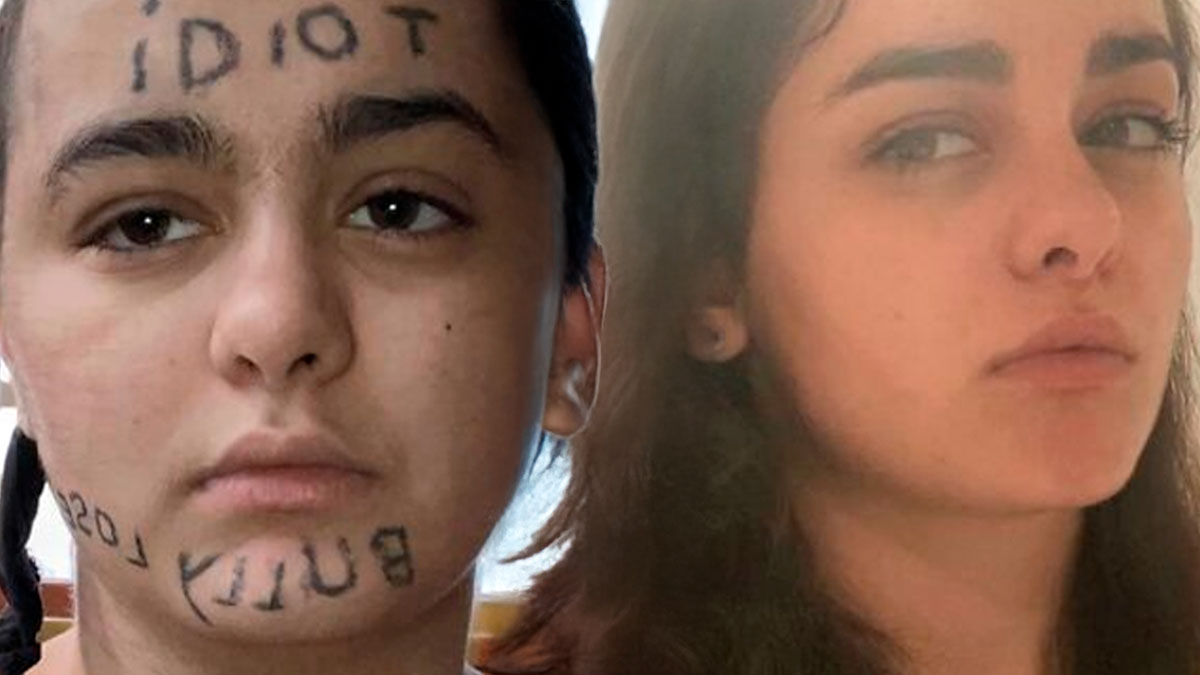Before and after photos showing tattoo mistakes removed from a young woman's face, highlighting tattoo mistake fixes.