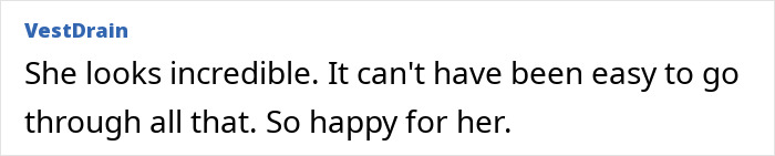 31-year-old woman with dwarfism who had height surgery as a teen shares stunning transformation with fans online 31-year-old woman with dwarfism who had height surgery as a teen shares stunning transformation with fans online