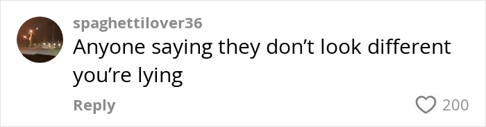 Comment on social media post discussing a woman's Kybella face transformation and her extreme recovery phase going viral. Comment on social media post discussing a woman's Kybella face transformation and her extreme recovery phase going viral.