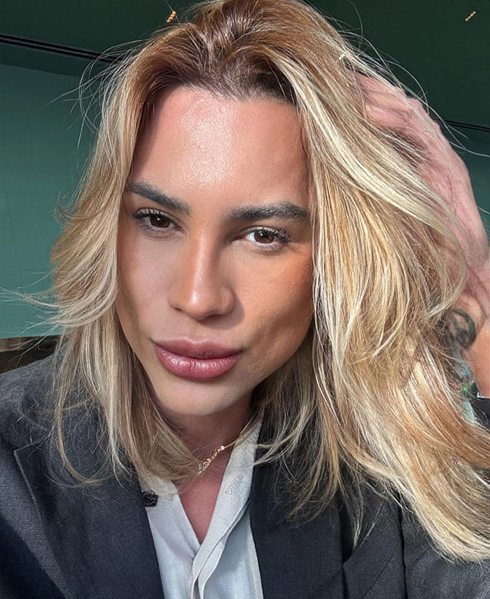 Influencer with blonde hair posing indoors, highlighting complications from popular Fox Eyes surgery procedure. Influencer with blonde hair posing indoors, highlighting complications from popular Fox Eyes surgery procedure.