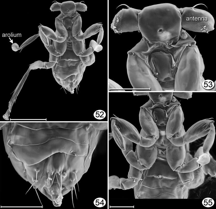 Close-up electron microscope images of an insanely small creature competing for smallest animal in the world title.