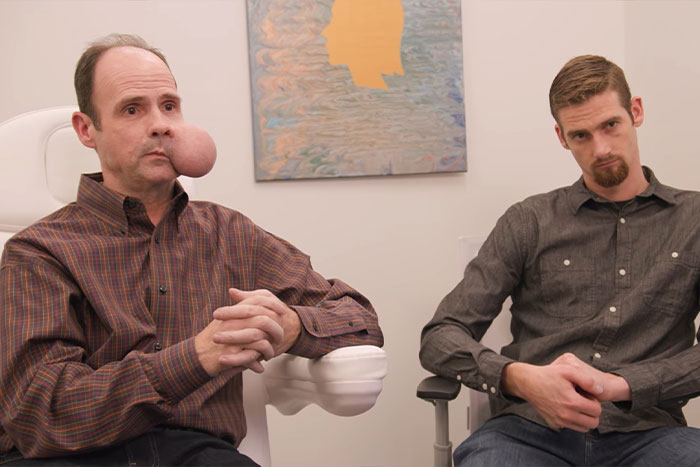 Man with 4-lb face tumor sitting in a clinic with another man, seeking urgent medical help amid fatal doctor warning. Man with 4-lb face tumor sitting in a clinic with another man, seeking urgent medical help amid fatal doctor warning.