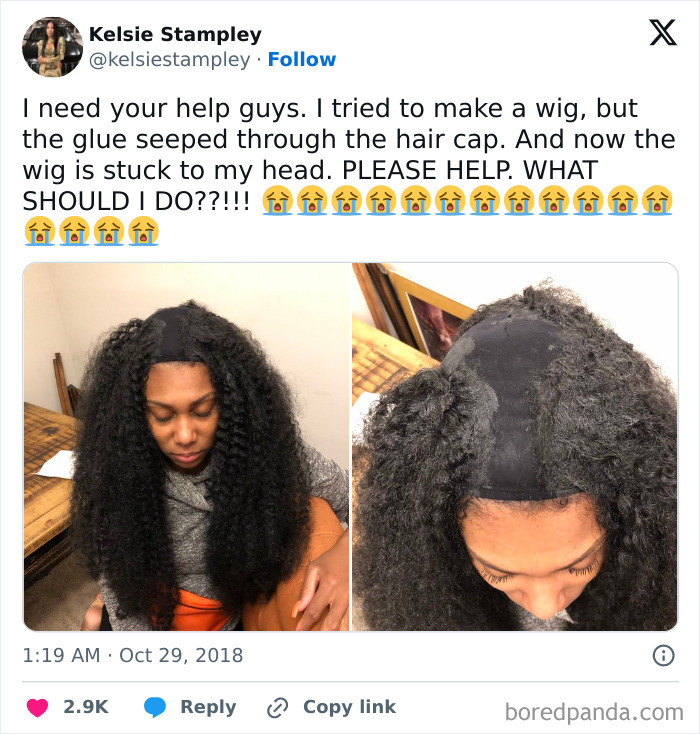 Woman with hair glued to scalp in a tragic hair accident showing stuck wig and distressed expression.