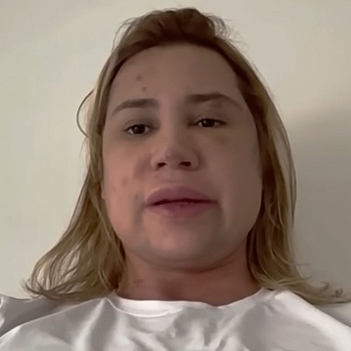 Influencer with blonde hair in a white shirt discussing complications from popular fox eyes surgery on a video call. Influencer with blonde hair in a white shirt discussing complications from popular fox eyes surgery on a video call.