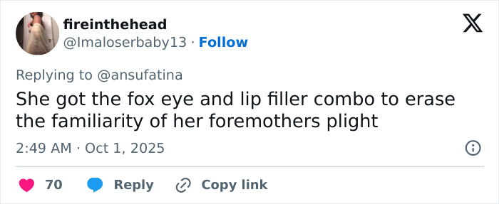 Tweet discussing Emma Stone's Louis Vuitton photos sparking plastic surgery speculation about fox eye and lip fillers. Tweet discussing Emma Stone's Louis Vuitton photos sparking plastic surgery speculation about fox eye and lip fillers.