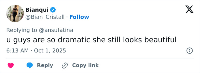 Twitter reply from Bianqui defending Emma Stone’s appearance amid Louis Vuitton plastic surgery speculation frenzy. Twitter reply from Bianqui defending Emma Stone’s appearance amid Louis Vuitton plastic surgery speculation frenzy.