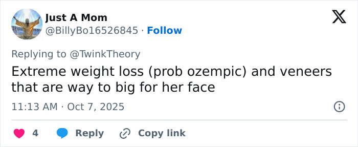 Tweet screenshot discussing Mandy Moore's unrecognizable new look with weight loss and oversized veneers. Tweet screenshot discussing Mandy Moore's unrecognizable new look with weight loss and oversized veneers.