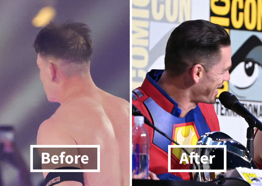 Before and after photos of a John Cena showing dramatic hair transplant results with improved hair density and style.