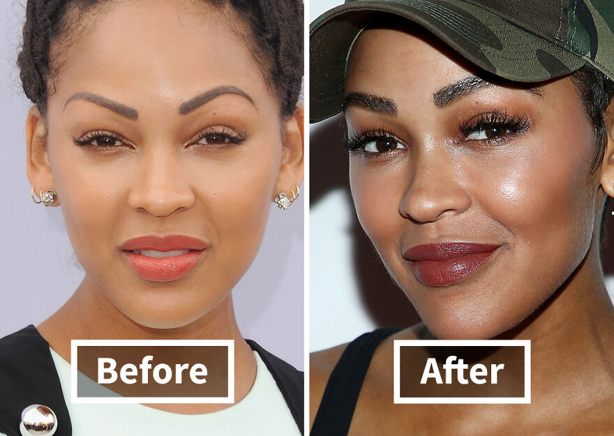 Close-up before and after photos of a Meagan Good showcasing results from hair transplant procedures.