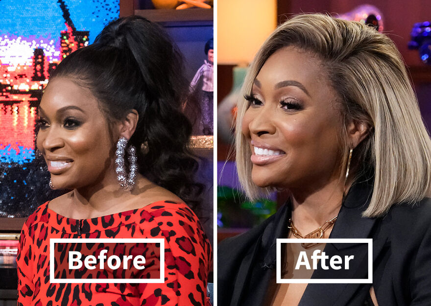 Before and after comparison of a Marlo Hampton showing results of hair transplant, highlighting celebrity hair transplant transformations.